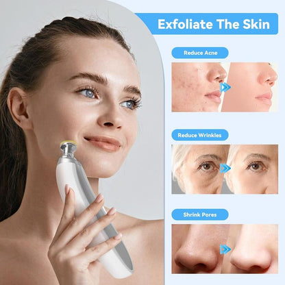 " Portable Blackhead Remover"
