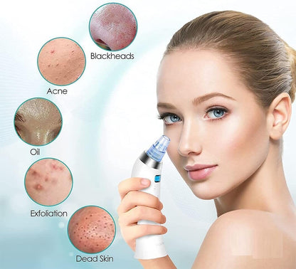 " Portable Blackhead Remover"